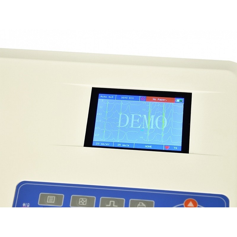 Ecg contec 300g - 3 csatorna kijelzővel