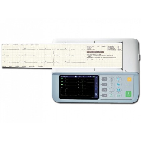 Mindray beneheart r3 ecg