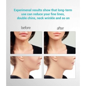 Anteaneck anti-wrinkle face and neck massager for skin firming