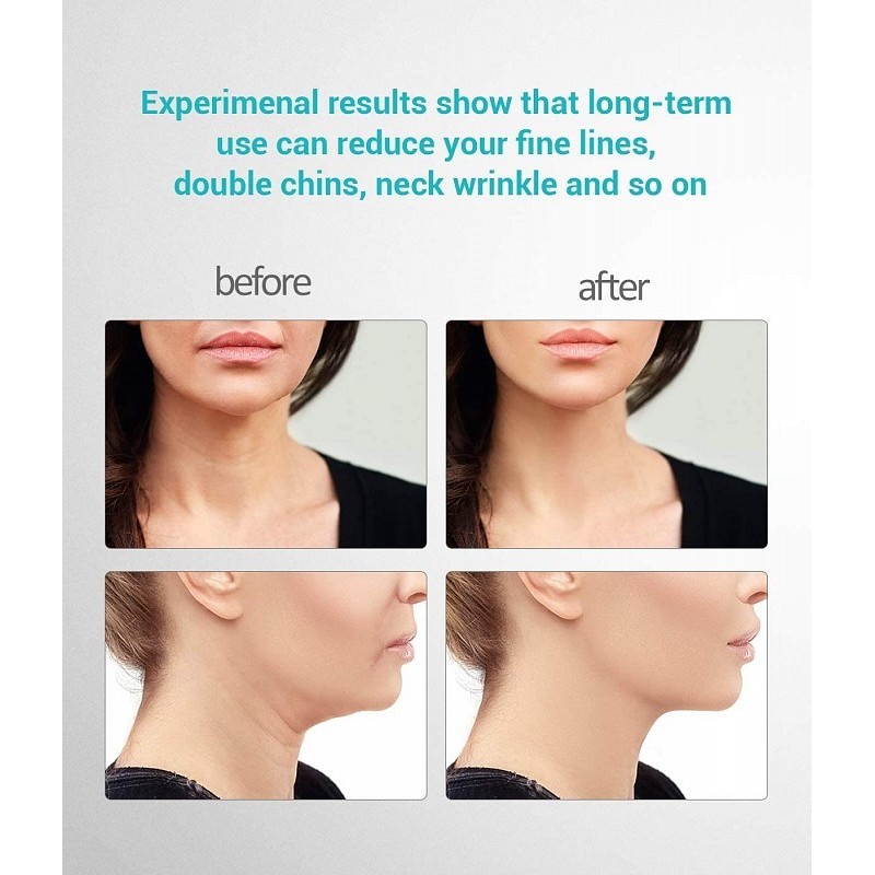 Anteaneck anti-wrinkle face and neck massager for skin firming