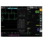 Gima Bm3 Pro Monitor - Spo2 + Ekg + Nibp + Temp + Resp