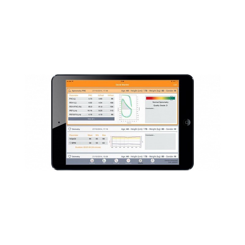 Kapesní spirometr mir spirobank 2 smart s oxymetrem