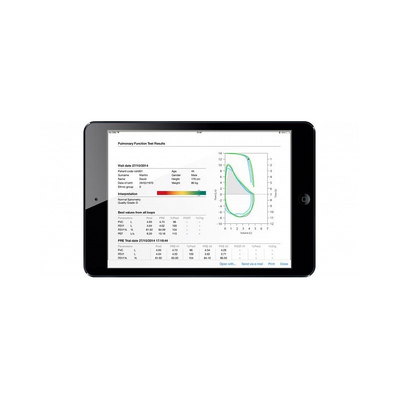 Spirometru de buzunar mir spirobank 2 smart cu oximetru