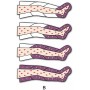 Presoterapia Presoterapia Ondas Intensas Presomasaje Una Pierna (con 1 pierna)