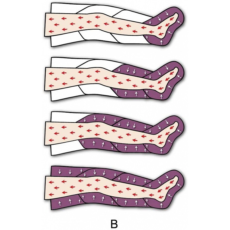 Pressoterapia pressomassaggio intense waves pressomassage two legs (con 2 gambali)