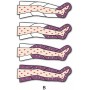 Pressoterapie Pressoterapie Intenzivní vlny Pressomasáž dvou nohou (se 2 legínami)