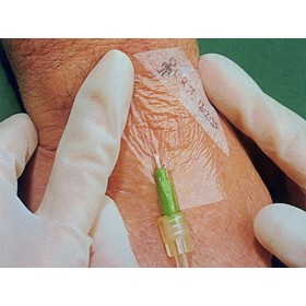 3m tegaderm film - prozirna sterilna obloga, 1624w 6x7 cm - 100 kom.