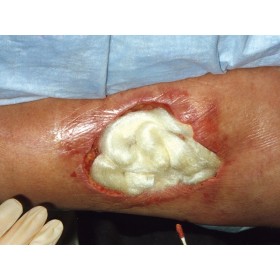 Tegaderm 3m alginato 10x10 cm - pack. 10 piezas