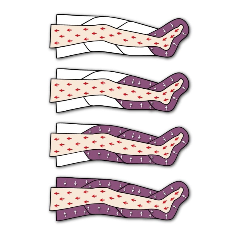 Medicinsk trykbehandling edimedical 1.0 til professionel og hjemmebrug med 2 leggings