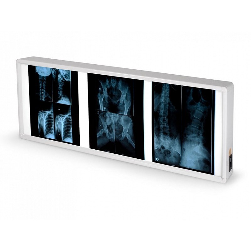 Radiographie double 38 x 92 cm