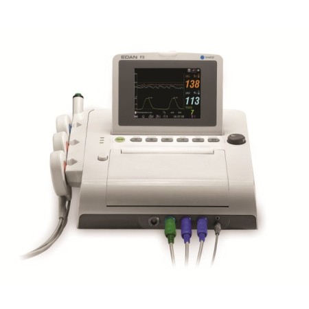 Fetal monitor - colors
