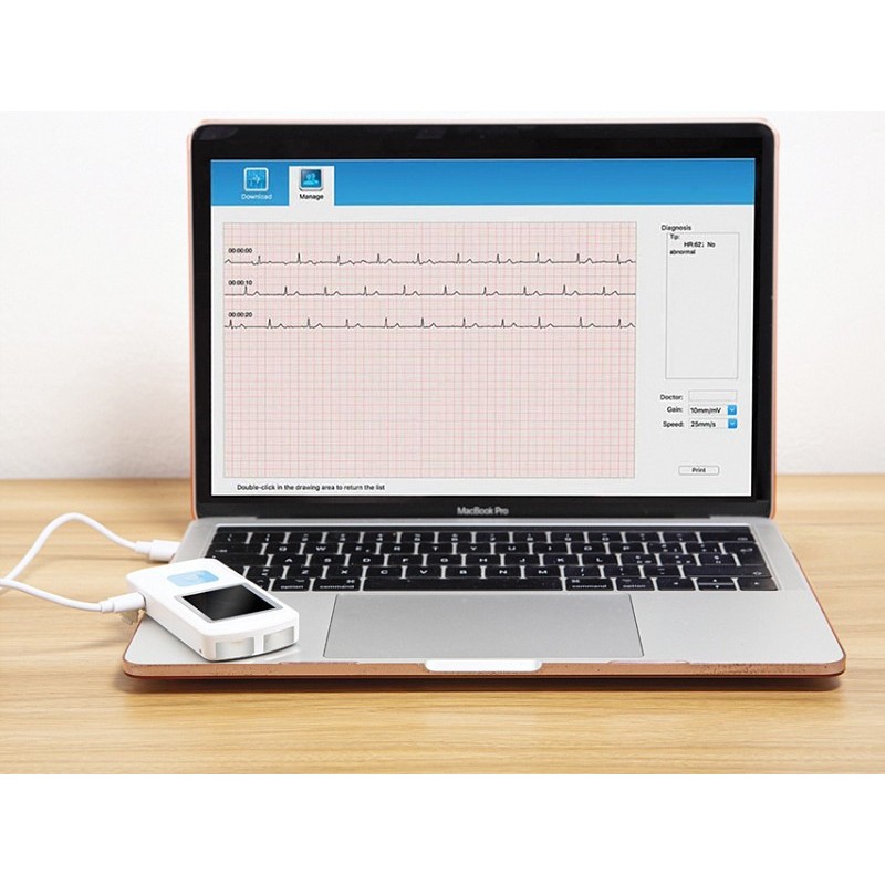 Ręczne ekg pm-10 bluetooth
