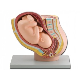 Pelvic model + fetus - 1x