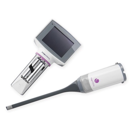 Adaptateur vidéo ambu ablade pour lames adultes