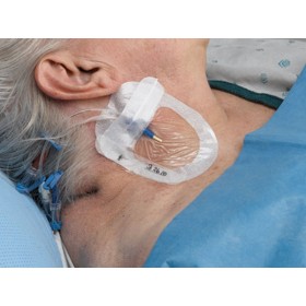 Tegaderm 3m 1685 iv advanced 8,5x11,5 cm pentru cablaje centrale - pachet 50 buc.