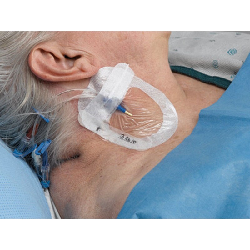 Tegaderm 3m 1685 iv advanced 8,5x11,5 cm pentru cablaje centrale - pachet 50 buc.