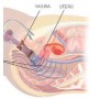 Elettrostimolatore perineale per incontinenza Beac IntelliSTIM BE-28UG