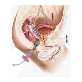Perineal elektrostimulator för inkontinens beac intellistim be-28ug