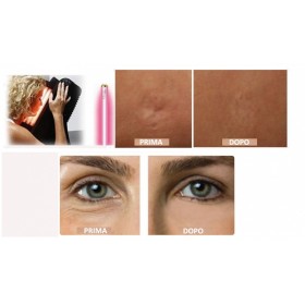 Lampă trifacială cu colagen, 12 tuburi, pentru fotostimularea colagenului