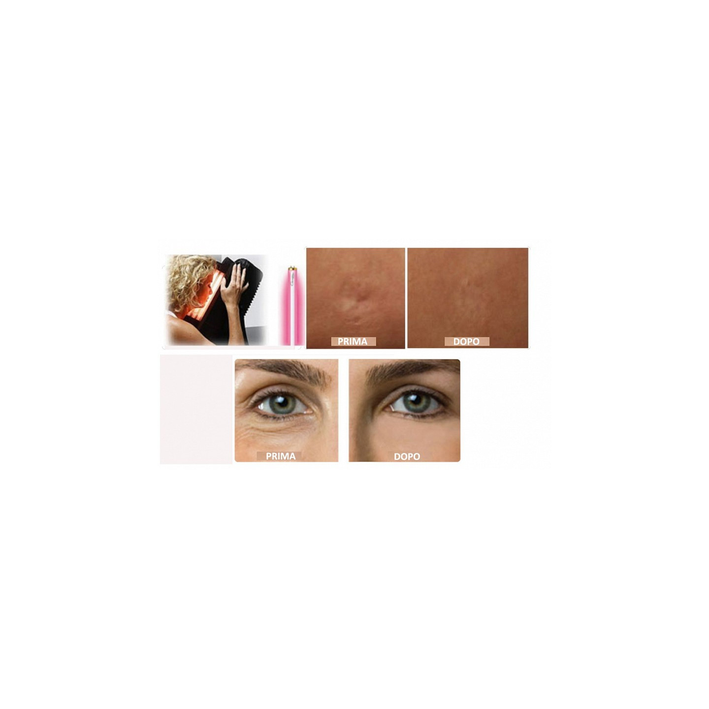 LAMPADA tri-facciale Collagen 12 Tubi per la fotostimolazione del collagene