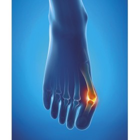 Epitact - protecție pentru hallux valgus - mică (36-38)