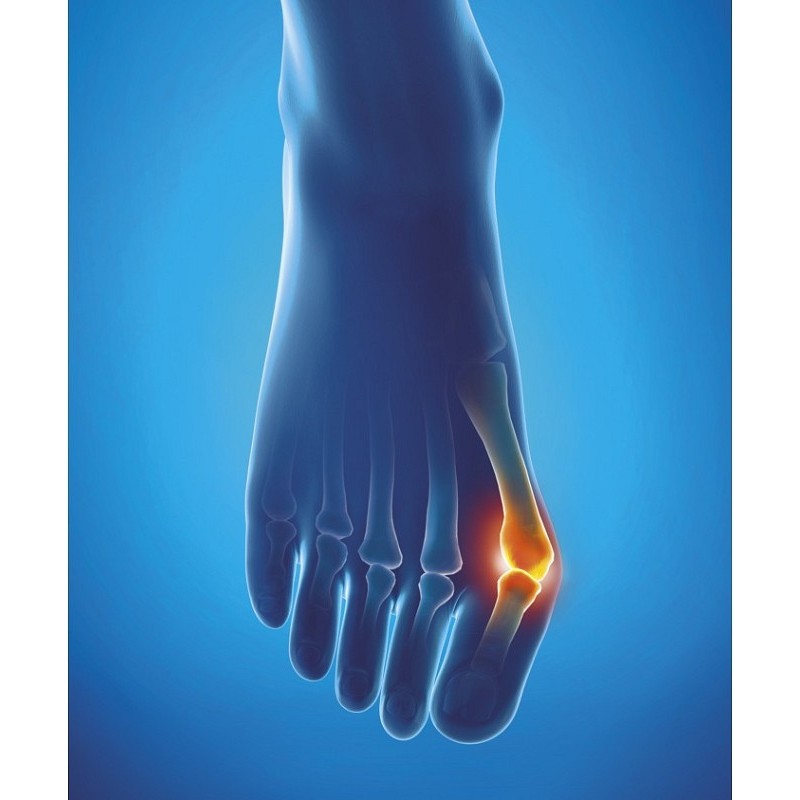 Epitact - foelux valgus bescherming - groot (42-45)