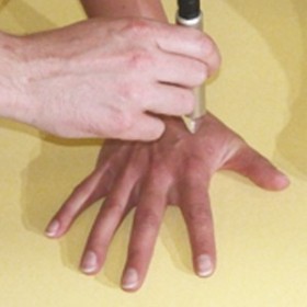 Physiolaser 2.0 laser therapy