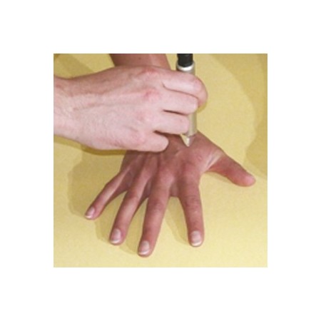 Laserová terapia physiolaser 2.0