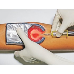 Przenośny wykrywacz żył veinspy