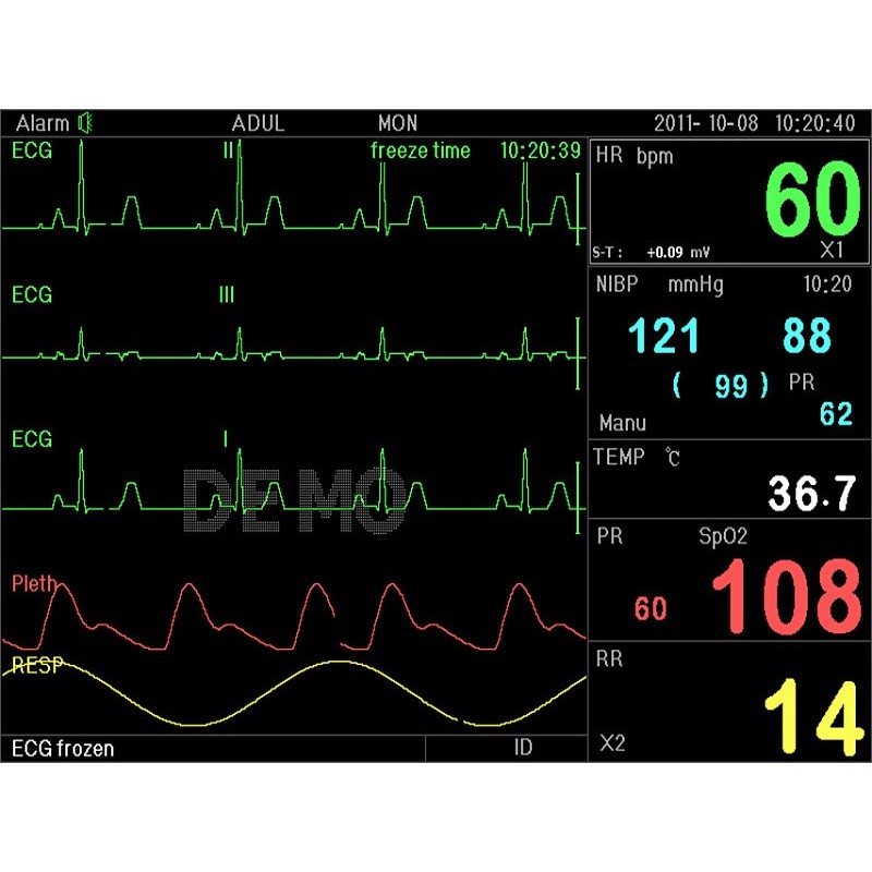 Pc-3000 multi-parameter-monitor