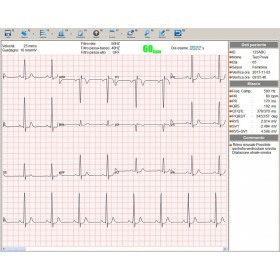 Bezprzewodowy elektrokardiograf pc-ekg euro ekg bt12