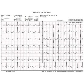 Drahtloser pc-ekg elektrokardiograph euro-ekg bt12