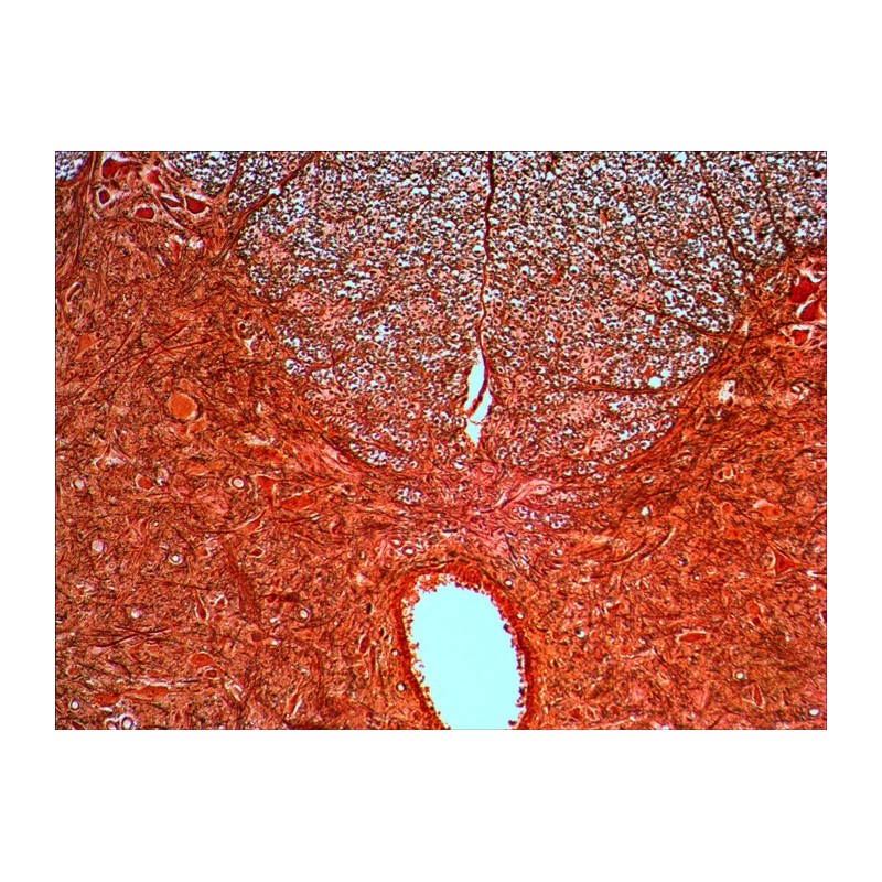 Levenhuk n20 ng voorbereide objectglaasjesset