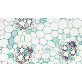 Bresser mikrokular full hd digitális okulárkamera