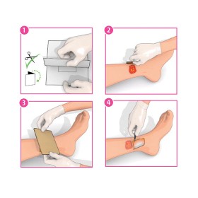 Inadine (pvp-i) medicazione non aderente p01491, 9.5 cm x 9.5 cm - 10 pz.