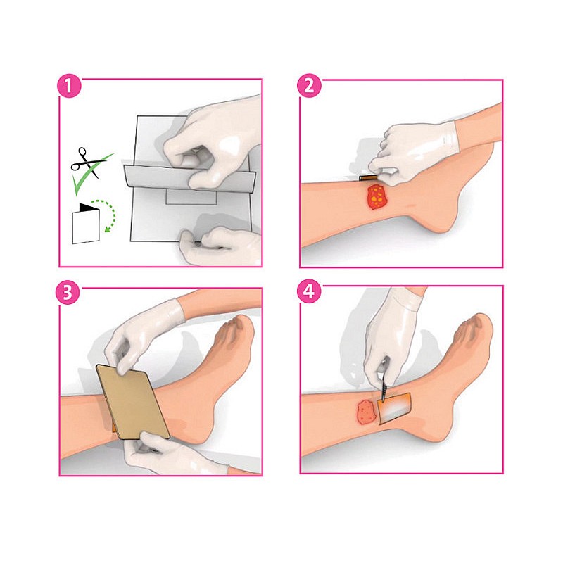 Inadine (pvp-i) medicazione non aderente p01491, 9.5 cm x 9.5 cm - 10 pz.