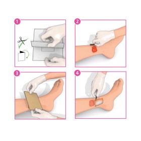 Inadine (pvp - i) pansament neaderent p01481, 5 cm x 5 cm - 25 buc.
