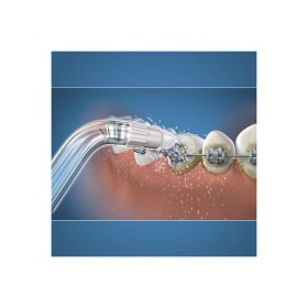 Waterpik - końcówka do irygatora ortodontycznego od - 100e - 2 szt.
