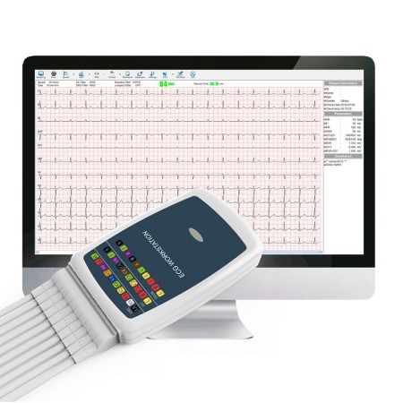Station de travail ecg sans fil contec 8000 - 12 canaux