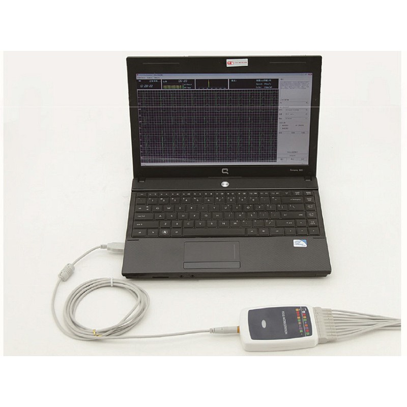 Estação de trabalho de ecg sem fio contec 8000 - 12 canais