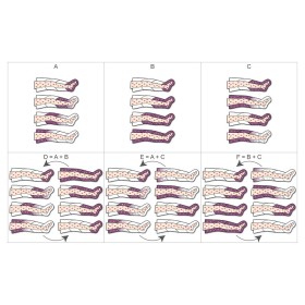 Pressotherapy pressomedical 6.0 komplett mit 2 leggings + slim body kit + 2 armbändern