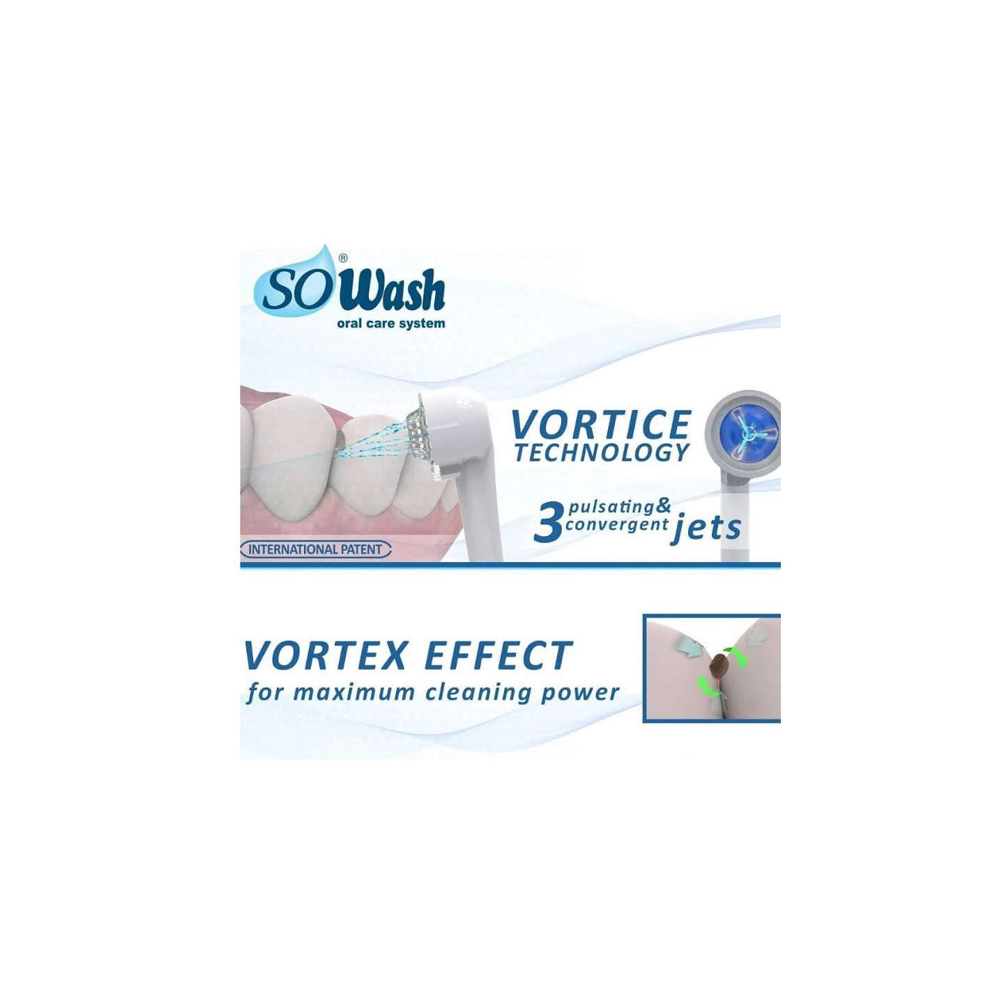 SOWASH Vortice Spacer — cserefejek, 2 darabos csomag