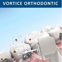 SOWASH Vortice Orthodontic — replacement heads, pack of 2