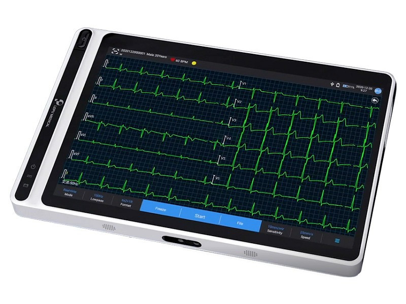 Canais ECG 6/12