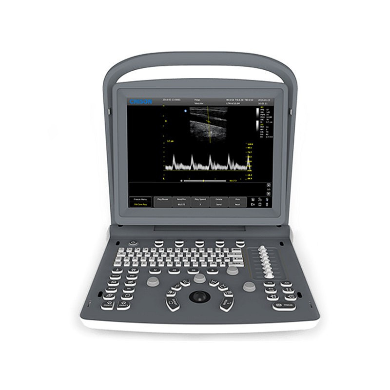 Ultralyd-Monitor