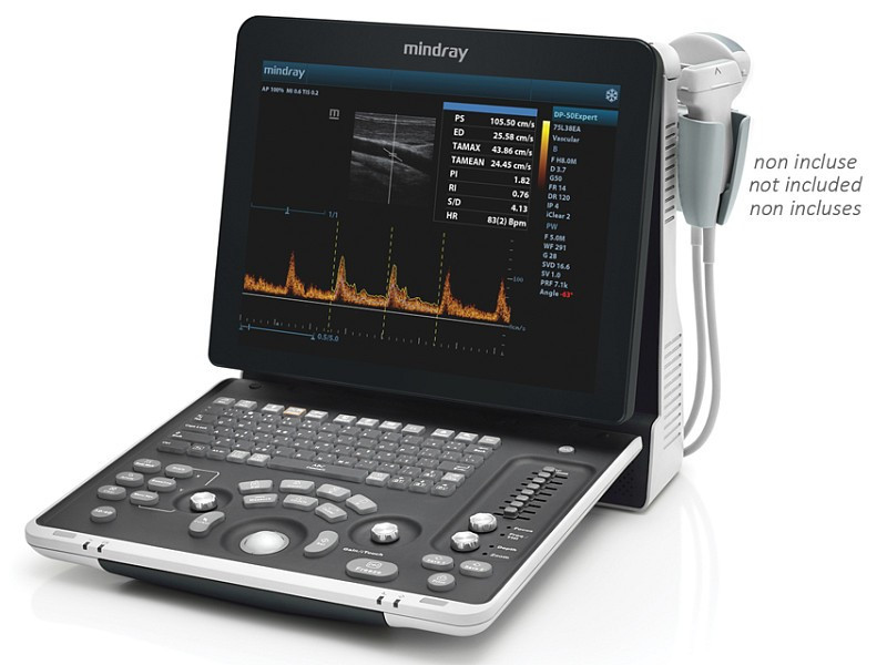 Ultrassom - Ultrassom Doppler